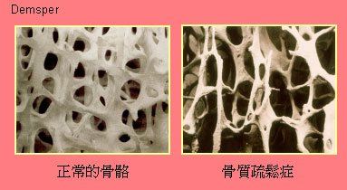 dvubb 圖片點擊可在新視窗打開檢視