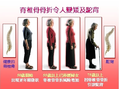 dvubb 圖片點擊可在新視窗打開檢視