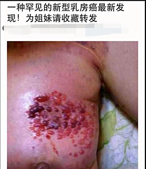 dvubb 圖片點擊可在新視窗打開檢視
