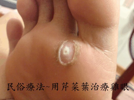 dvubb 圖片點擊可在新視窗打開檢視