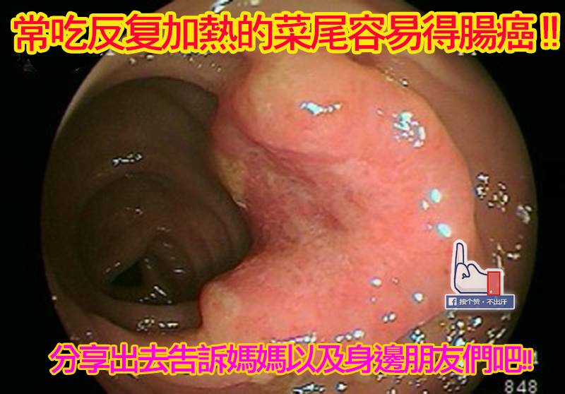 dvubb 圖片點擊可在新視窗打開檢視